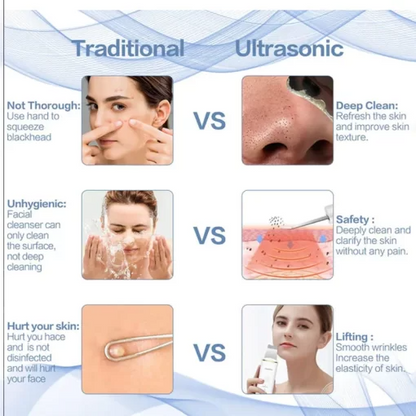 Addictivehub® Ultrasonic Facial Skin Scrubber